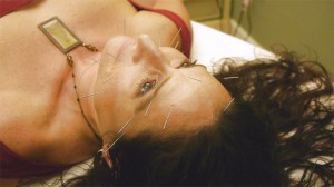 gail 3 acupuncture